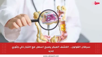 سرطان القولون.. الكشف المبكر يصبح أسهل مع اختبار ذكي وثوري جديد